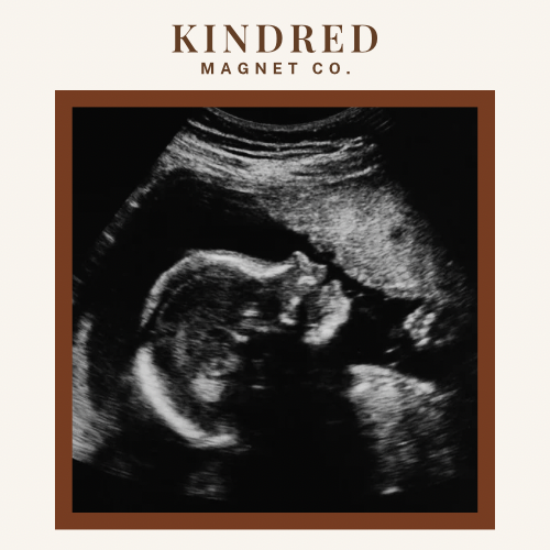 Tiny Kicks Set🤍👶